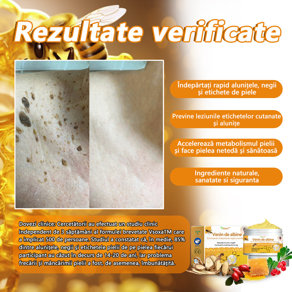 🧄𝐕𝐬𝐨𝐱𝐚™ 𝐕𝐞𝐧𝐢𝐧 𝐝𝐞 𝐚𝐥𝐛𝐢𝐧𝐞 𝐂𝐫𝐞𝐦ă 𝐩𝐞𝐧𝐭𝐫𝐮 î𝐧𝐝𝐞𝐩ä𝐫𝐭𝐚𝐫𝐞𝐚 𝐧𝐞𝐠𝐢𝐥𝐨𝐫 ş𝐢 𝐚𝐥𝐮𝐧𝐢𝐭𝐞𝐥𝐨𝐫🐝🐝(🔥𝙋𝙧𝙤𝙢𝙤ț𝙞𝙖 𝙙𝙚 𝙪𝙡𝙩𝙞𝙢𝙖 𝙯𝙞 𝟖𝟎% 𝙧𝙚𝙙𝙪𝙘𝙚𝙧𝙚)