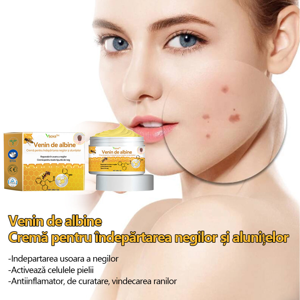 🧄𝐕𝐬𝐨𝐱𝐚™ 𝐕𝐞𝐧𝐢𝐧 𝐝𝐞 𝐚𝐥𝐛𝐢𝐧𝐞 𝐂𝐫𝐞𝐦ă 𝐩𝐞𝐧𝐭𝐫𝐮 î𝐧𝐝𝐞𝐩ä𝐫𝐭𝐚𝐫𝐞𝐚 𝐧𝐞𝐠𝐢𝐥𝐨𝐫 ş𝐢 𝐚𝐥𝐮𝐧𝐢𝐭𝐞𝐥𝐨𝐫🐝🐝(🔥𝙋𝙧𝙤𝙢𝙤ț𝙞𝙖 𝙙𝙚 𝙪𝙡𝙩𝙞𝙢𝙖 𝙯𝙞 𝟖𝟎% 𝙧𝙚𝙙𝙪𝙘𝙚𝙧𝙚)
