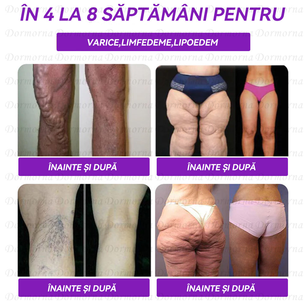 Recomandat de Spitalul Universitar Bucuresti| Magazin oficial | 𝐃𝐨𝐫𝐦𝐨𝐫𝐧𝐚®🧚♀️𝐆𝐋𝐏-𝟏 𝐋𝐢𝐜𝐡𝐢𝐝 𝐨𝐫𝐚𝐥--✅Programe revoluționare de control științific al zahărului GLP-1 și de scădere în greutate