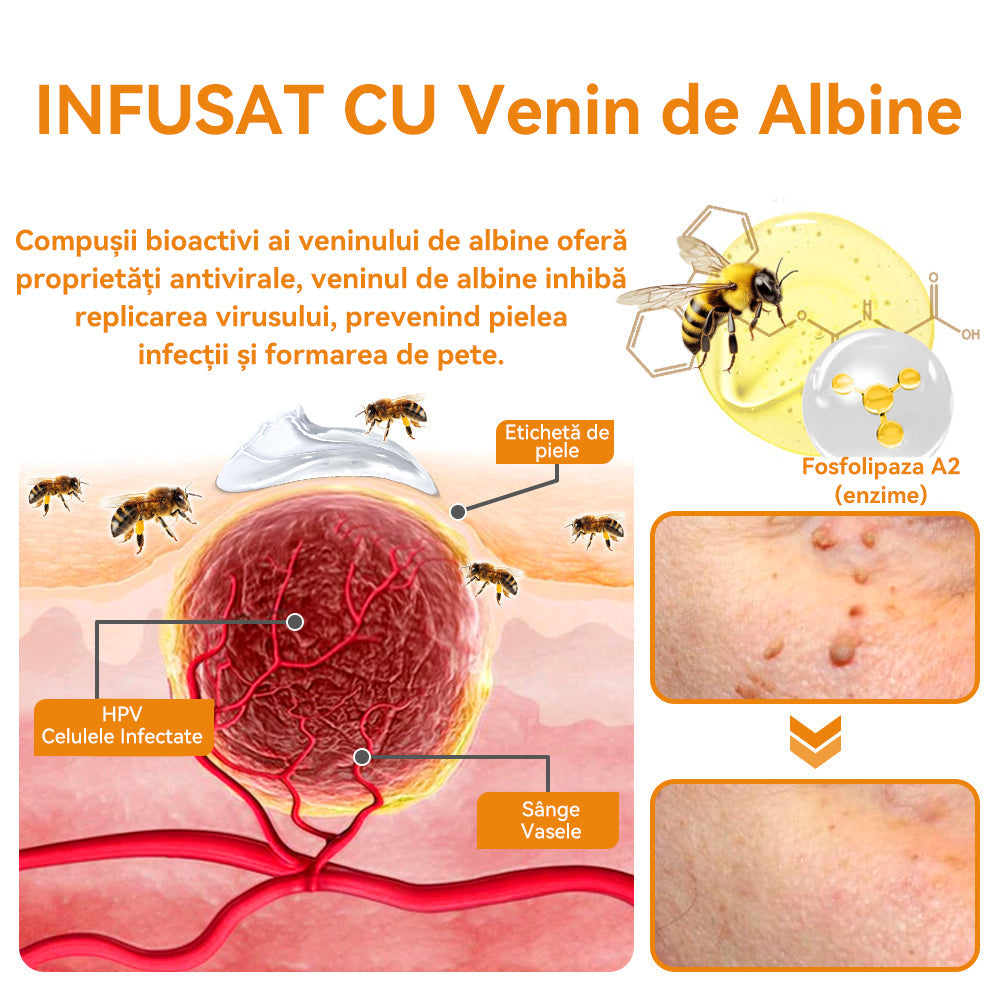 🧄𝐕𝐬𝐨𝐱𝐚™ 𝐕𝐞𝐧𝐢𝐧 𝐝𝐞 𝐚𝐥𝐛𝐢𝐧𝐞 𝐂𝐫𝐞𝐦ă 𝐩𝐞𝐧𝐭𝐫𝐮 î𝐧𝐝𝐞𝐩ä𝐫𝐭𝐚𝐫𝐞𝐚 𝐧𝐞𝐠𝐢𝐥𝐨𝐫 ş𝐢 𝐚𝐥𝐮𝐧𝐢𝐭𝐞𝐥𝐨𝐫🐝🐝(🔥𝙋𝙧𝙤𝙢𝙤ț𝙞𝙖 𝙙𝙚 𝙪𝙡𝙩𝙞𝙢𝙖 𝙯𝙞 𝟖𝟎% 𝙧𝙚𝙙𝙪𝙘𝙚𝙧𝙚)