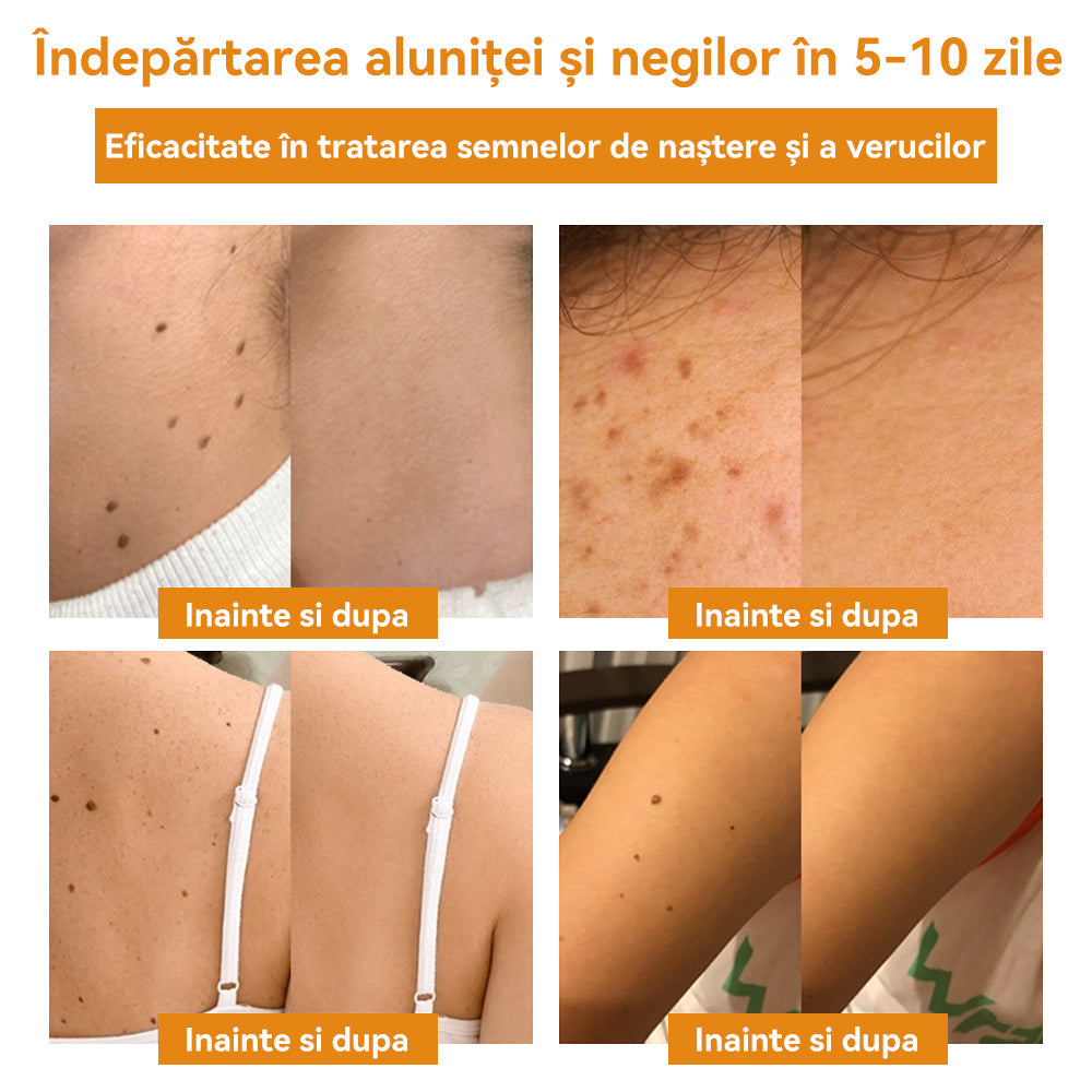 🧄𝐕𝐬𝐨𝐱𝐚™ 𝐕𝐞𝐧𝐢𝐧 𝐝𝐞 𝐚𝐥𝐛𝐢𝐧𝐞 𝐂𝐫𝐞𝐦ă 𝐩𝐞𝐧𝐭𝐫𝐮 î𝐧𝐝𝐞𝐩ä𝐫𝐭𝐚𝐫𝐞𝐚 𝐧𝐞𝐠𝐢𝐥𝐨𝐫 ş𝐢 𝐚𝐥𝐮𝐧𝐢𝐭𝐞𝐥𝐨𝐫🐝🐝(🔥𝙋𝙧𝙤𝙢𝙤ț𝙞𝙖 𝙙𝙚 𝙪𝙡𝙩𝙞𝙢𝙖 𝙯𝙞 𝟖𝟎% 𝙧𝙚𝙙𝙪𝙘𝙚𝙧𝙚)