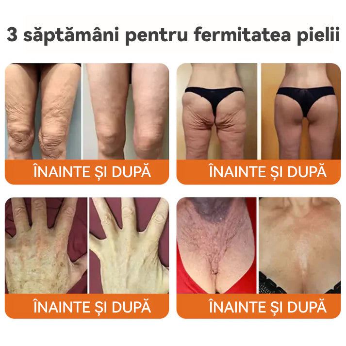 "Fabricat și expediat din România | 𝐒𝐩𝐳𝐯® 🐩𝐁𝐎𝐓𝐎𝐗 𝐕𝐞𝐧𝐢𝐧 𝐝𝐞 𝐚𝐥𝐛𝐢𝐧𝐞 𝐂𝐫𝐞𝐦ă 𝐝𝐞 𝐭𝐫𝐚𝐭𝐚𝐦𝐞𝐧𝐭 𝐦𝐮𝐥𝐭𝐢𝐟𝐮𝐧𝐜ț𝐢𝐨𝐧𝐚𝐥ă | ULTIMA ZI 80% REDUCERE "
