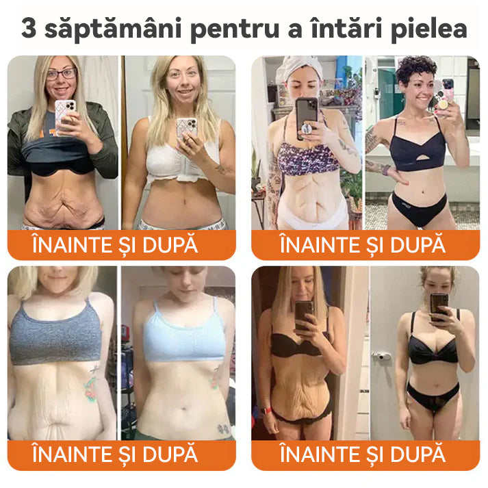 "Fabricat și expediat din România | 𝐒𝐩𝐳𝐯® 🐩𝐁𝐎𝐓𝐎𝐗 𝐕𝐞𝐧𝐢𝐧 𝐝𝐞 𝐚𝐥𝐛𝐢𝐧𝐞 𝐂𝐫𝐞𝐦ă 𝐝𝐞 𝐭𝐫𝐚𝐭𝐚𝐦𝐞𝐧𝐭 𝐦𝐮𝐥𝐭𝐢𝐟𝐮𝐧𝐜ț𝐢𝐨𝐧𝐚𝐥ă | ULTIMA ZI 80% REDUCERE "