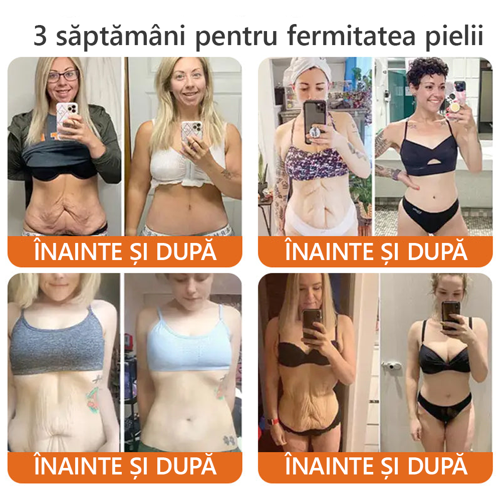 Fabricat si livrat din Romania ✨𝐃𝐨𝐫𝐦𝐨𝐫𝐧𝐚® 𝐕𝐞𝐧𝐢𝐧 𝐝𝐞 𝐚𝐥𝐛𝐢𝐧𝐞 𝐜𝐮𝐩𝐫𝐢𝐧𝐳ă𝐭𝐨𝐚𝐫𝐞 𝐂𝐫𝐞𝐦ă 🔥 ULTIMA ZI 80% REDUCERE 💎💎