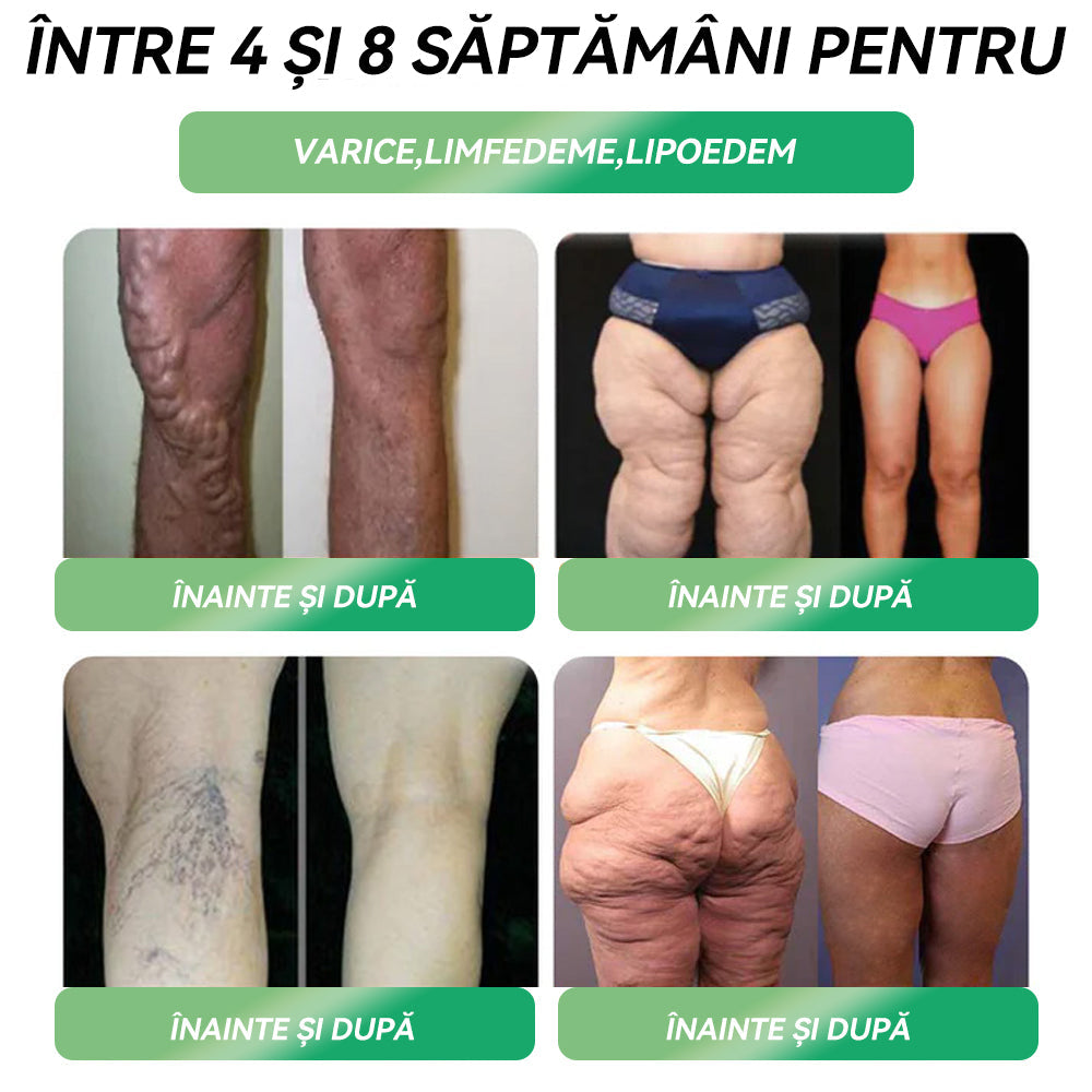 Institutul Clinic Fundeni Recomandat | Magazin oficial | 💗𝑆𝑇𝐷𝐸𝐼® 𝐺𝐿𝑃-1 𝑃𝑖𝑒𝑟𝑑𝑒𝑟𝑒 î𝑛 𝑔𝑟𝑒𝑢𝑡𝑎𝑡𝑒 𝑆𝑜𝑙𝑢ț𝑖𝑒 𝑜𝑟𝑎𝑙ă - 👨⚕️ Obezitate, boli cardiovasculare, diabet, apnee în somn, probleme articulare și multe altele
