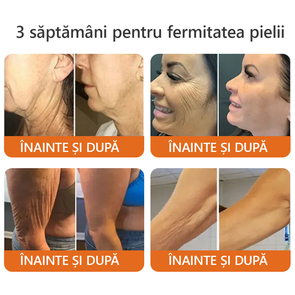 Fabricat si livrat din Romania ✨𝐃𝐨𝐫𝐦𝐨𝐫𝐧𝐚® 𝐕𝐞𝐧𝐢𝐧 𝐝𝐞 𝐚𝐥𝐛𝐢𝐧𝐞 𝐜𝐮𝐩𝐫𝐢𝐧𝐳ă𝐭𝐨𝐚𝐫𝐞 𝐂𝐫𝐞𝐦ă 🔥 ULTIMA ZI 80% REDUCERE 💎💎