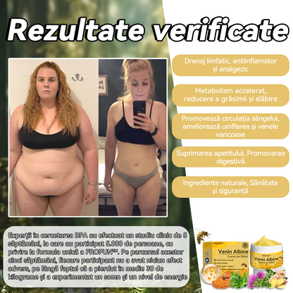 🧚🏻‍♂️𝑭𝑹𝑶𝑷𝑼𝑵™ Venin Albine Cremă de Slăbit⭐(Pentru toate problemele de limfă și obezitate)