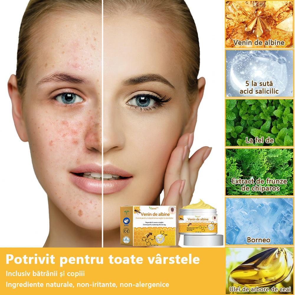 🧄𝐕𝐬𝐨𝐱𝐚™ 𝐕𝐞𝐧𝐢𝐧 𝐝𝐞 𝐚𝐥𝐛𝐢𝐧𝐞 𝐂𝐫𝐞𝐦ă 𝐩𝐞𝐧𝐭𝐫𝐮 î𝐧𝐝𝐞𝐩ä𝐫𝐭𝐚𝐫𝐞𝐚 𝐧𝐞𝐠𝐢𝐥𝐨𝐫 ş𝐢 𝐚𝐥𝐮𝐧𝐢𝐭𝐞𝐥𝐨𝐫🐝🐝(🔥𝙋𝙧𝙤𝙢𝙤ț𝙞𝙖 𝙙𝙚 𝙪𝙡𝙩𝙞𝙢𝙖 𝙯𝙞 𝟖𝟎% 𝙧𝙚𝙙𝙪𝙘𝙚𝙧𝙚)