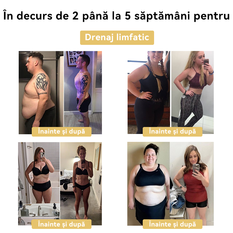 🧚🏻‍♂️𝑭𝑹𝑶𝑷𝑼𝑵™ Venin Albine Cremă de Slăbit⭐(Pentru toate problemele de limfă și obezitate)