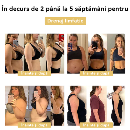 🧚🏻‍♂️𝑭𝑹𝑶𝑷𝑼𝑵™ Venin Albine Cremă de Slăbit⭐(Pentru toate problemele de limfă și obezitate)