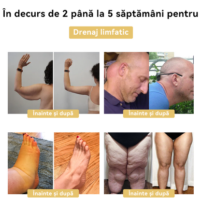 🧚🏻‍♂️𝑭𝑹𝑶𝑷𝑼𝑵™ Venin Albine Cremă de Slăbit⭐(Pentru toate problemele de limfă și obezitate)