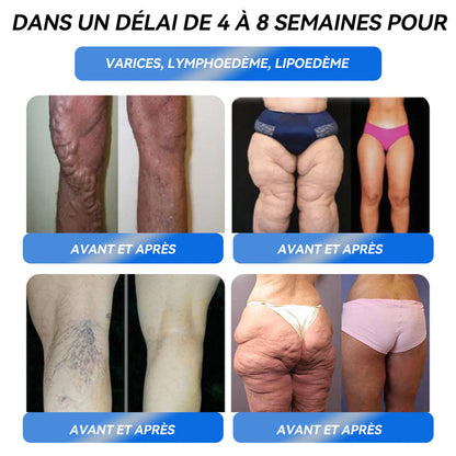 𝐈𝐅𝐌𝐀𝐆𝐈𝐂® 𝐆𝐋𝐏-𝟏 𝐏𝐫𝐨 𝐒𝐨𝐥𝐮𝐭𝐢𝐨𝐧 𝐨𝐫𝐚𝐥𝐞 𝐩𝐨𝐮𝐫 𝐥𝐚 𝐩𝐞𝐫𝐭𝐞 𝐝𝐞 𝐩𝐨𝐢𝐝𝐬🌼💖