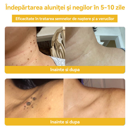 🥝𝑺𝒑𝒛𝒗™ 𝑽𝒆𝒏𝒊𝒏 𝒅𝒆 𝒂𝒍𝒃𝒊𝒏𝒆 𝑪𝒓𝒆𝒎ă 𝒅𝒆 𝒕𝒓𝒂𝒕𝒂𝒎𝒆𝒏𝒕 𝒑𝒆𝒏𝒕𝒓𝒖 𝒂𝒍𝒖𝒏𝒊ț𝒆 ș𝒊 𝒗𝒆𝒓𝒖𝒄𝒊 ⚡⚡(🧑‍⚕️𝑹𝒆𝒄𝒐𝒎𝒂𝒏𝒅𝒂𝒓𝒆𝒂 𝒅𝒆𝒓𝒎𝒂𝒕𝒐𝒍𝒐𝒈𝒖𝒍𝒖𝒊 𝒔𝒑𝒆𝒄𝒊𝒂𝒍𝒊𝒔𝒕🔥🔥𝑼𝒍𝒕𝒊𝒎𝒂 𝒛𝒊 𝒅𝒆 𝒑𝒓𝒐𝒎𝒐𝒗𝒂𝒓𝒆𝒍 80% 𝒐𝒇𝒇)