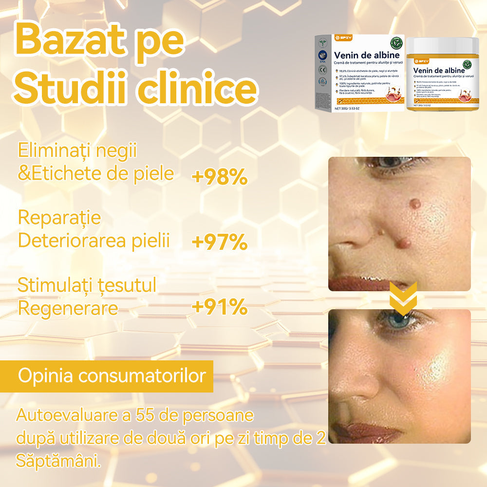 🥝𝑺𝒑𝒛𝒗™ 𝑽𝒆𝒏𝒊𝒏 𝒅𝒆 𝒂𝒍𝒃𝒊𝒏𝒆 𝑪𝒓𝒆𝒎ă 𝒅𝒆 𝒕𝒓𝒂𝒕𝒂𝒎𝒆𝒏𝒕 𝒑𝒆𝒏𝒕𝒓𝒖 𝒂𝒍𝒖𝒏𝒊ț𝒆 ș𝒊 𝒗𝒆𝒓𝒖𝒄𝒊 ⚡⚡(🧑‍⚕️𝑹𝒆𝒄𝒐𝒎𝒂𝒏𝒅𝒂𝒓𝒆𝒂 𝒅𝒆𝒓𝒎𝒂𝒕𝒐𝒍𝒐𝒈𝒖𝒍𝒖𝒊 𝒔𝒑𝒆𝒄𝒊𝒂𝒍𝒊𝒔𝒕🔥🔥𝑼𝒍𝒕𝒊𝒎𝒂 𝒛𝒊 𝒅𝒆 𝒑𝒓𝒐𝒎𝒐𝒗𝒂𝒓𝒆𝒍 80% 𝒐𝒇𝒇)