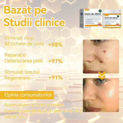 🥝𝑺𝒑𝒛𝒗™ 𝑽𝒆𝒏𝒊𝒏 𝒅𝒆 𝒂𝒍𝒃𝒊𝒏𝒆 𝑪𝒓𝒆𝒎ă 𝒅𝒆 𝒕𝒓𝒂𝒕𝒂𝒎𝒆𝒏𝒕 𝒑𝒆𝒏𝒕𝒓𝒖 𝒂𝒍𝒖𝒏𝒊ț𝒆 ș𝒊 𝒗𝒆𝒓𝒖𝒄𝒊 ⚡⚡(🧑‍⚕️𝑹𝒆𝒄𝒐𝒎𝒂𝒏𝒅𝒂𝒓𝒆𝒂 𝒅𝒆𝒓𝒎𝒂𝒕𝒐𝒍𝒐𝒈𝒖𝒍𝒖𝒊 𝒔𝒑𝒆𝒄𝒊𝒂𝒍𝒊𝒔𝒕🔥🔥𝑼𝒍𝒕𝒊𝒎𝒂 𝒛𝒊 𝒅𝒆 𝒑𝒓𝒐𝒎𝒐𝒗𝒂𝒓𝒆𝒍 80% 𝒐𝒇𝒇)