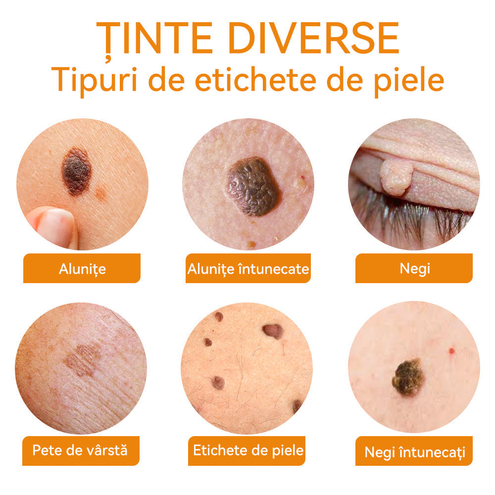 🧄𝐕𝐬𝐨𝐱𝐚™ 𝐕𝐞𝐧𝐢𝐧 𝐝𝐞 𝐚𝐥𝐛𝐢𝐧𝐞 𝐂𝐫𝐞𝐦ă 𝐩𝐞𝐧𝐭𝐫𝐮 î𝐧𝐝𝐞𝐩ä𝐫𝐭𝐚𝐫𝐞𝐚 𝐧𝐞𝐠𝐢𝐥𝐨𝐫 ş𝐢 𝐚𝐥𝐮𝐧𝐢𝐭𝐞𝐥𝐨𝐫🐝🐝(🔥𝙋𝙧𝙤𝙢𝙤ț𝙞𝙖 𝙙𝙚 𝙪𝙡𝙩𝙞𝙢𝙖 𝙯𝙞 𝟖𝟎% 𝙧𝙚𝙙𝙪𝙘𝙚𝙧𝙚)