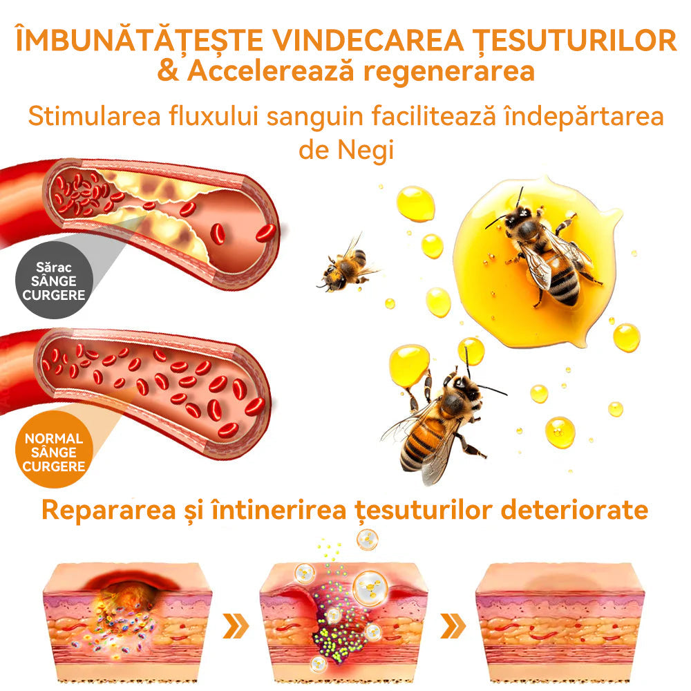 🧄𝐕𝐬𝐨𝐱𝐚™ 𝐕𝐞𝐧𝐢𝐧 𝐝𝐞 𝐚𝐥𝐛𝐢𝐧𝐞 𝐂𝐫𝐞𝐦ă 𝐩𝐞𝐧𝐭𝐫𝐮 î𝐧𝐝𝐞𝐩ä𝐫𝐭𝐚𝐫𝐞𝐚 𝐧𝐞𝐠𝐢𝐥𝐨𝐫 ş𝐢 𝐚𝐥𝐮𝐧𝐢𝐭𝐞𝐥𝐨𝐫🐝🐝(🔥𝙋𝙧𝙤𝙢𝙤ț𝙞𝙖 𝙙𝙚 𝙪𝙡𝙩𝙞𝙢𝙖 𝙯𝙞 𝟖𝟎% 𝙧𝙚𝙙𝙪𝙘𝙚𝙧𝙚)