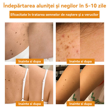 🧄𝐕𝐬𝐨𝐱𝐚™ 𝐕𝐞𝐧𝐢𝐧 𝐝𝐞 𝐚𝐥𝐛𝐢𝐧𝐞 𝐂𝐫𝐞𝐦ă 𝐩𝐞𝐧𝐭𝐫𝐮 î𝐧𝐝𝐞𝐩ä𝐫𝐭𝐚𝐫𝐞𝐚 𝐧𝐞𝐠𝐢𝐥𝐨𝐫 ş𝐢 𝐚𝐥𝐮𝐧𝐢𝐭𝐞𝐥𝐨𝐫🐝🐝(🔥𝙋𝙧𝙤𝙢𝙤ț𝙞𝙖 𝙙𝙚 𝙪𝙡𝙩𝙞𝙢𝙖 𝙯𝙞 𝟖𝟎% 𝙧𝙚𝙙𝙪𝙘𝙚𝙧𝙚)