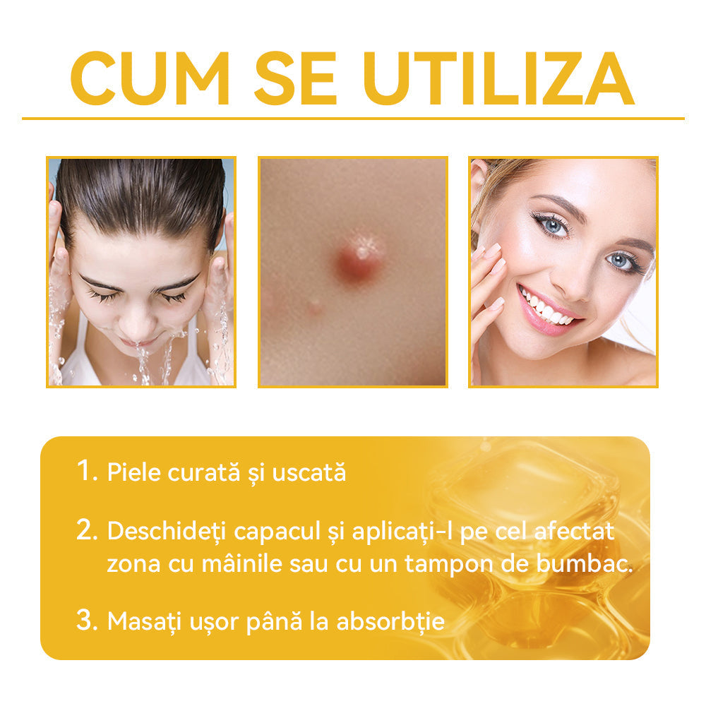 🥝𝑺𝒑𝒛𝒗™ 𝑽𝒆𝒏𝒊𝒏 𝒅𝒆 𝒂𝒍𝒃𝒊𝒏𝒆 𝑪𝒓𝒆𝒎ă 𝒅𝒆 𝒕𝒓𝒂𝒕𝒂𝒎𝒆𝒏𝒕 𝒑𝒆𝒏𝒕𝒓𝒖 𝒂𝒍𝒖𝒏𝒊ț𝒆 ș𝒊 𝒗𝒆𝒓𝒖𝒄𝒊 ⚡⚡(🧑‍⚕️𝑹𝒆𝒄𝒐𝒎𝒂𝒏𝒅𝒂𝒓𝒆𝒂 𝒅𝒆𝒓𝒎𝒂𝒕𝒐𝒍𝒐𝒈𝒖𝒍𝒖𝒊 𝒔𝒑𝒆𝒄𝒊𝒂𝒍𝒊𝒔𝒕🔥🔥𝑼𝒍𝒕𝒊𝒎𝒂 𝒛𝒊 𝒅𝒆 𝒑𝒓𝒐𝒎𝒐𝒗𝒂𝒓𝒆𝒍 80% 𝒐𝒇𝒇)
