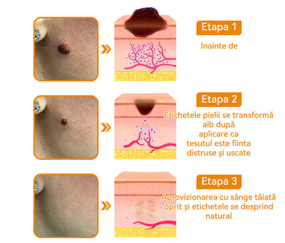 🧄𝐕𝐬𝐨𝐱𝐚™ 𝐕𝐞𝐧𝐢𝐧 𝐝𝐞 𝐚𝐥𝐛𝐢𝐧𝐞 𝐂𝐫𝐞𝐦ă 𝐩𝐞𝐧𝐭𝐫𝐮 î𝐧𝐝𝐞𝐩ä𝐫𝐭𝐚𝐫𝐞𝐚 𝐧𝐞𝐠𝐢𝐥𝐨𝐫 ş𝐢 𝐚𝐥𝐮𝐧𝐢𝐭𝐞𝐥𝐨𝐫🐝🐝(🔥𝙋𝙧𝙤𝙢𝙤ț𝙞𝙖 𝙙𝙚 𝙪𝙡𝙩𝙞𝙢𝙖 𝙯𝙞 𝟖𝟎% 𝙧𝙚𝙙𝙪𝙘𝙚𝙧𝙚)