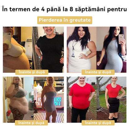🧚🏻‍♂️𝑭𝑹𝑶𝑷𝑼𝑵™ Venin Albine Cremă de Slăbit⭐(Pentru toate problemele de limfă și obezitate)