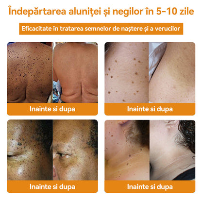 🧄𝐕𝐬𝐨𝐱𝐚™ 𝐕𝐞𝐧𝐢𝐧 𝐝𝐞 𝐚𝐥𝐛𝐢𝐧𝐞 𝐂𝐫𝐞𝐦ă 𝐩𝐞𝐧𝐭𝐫𝐮 î𝐧𝐝𝐞𝐩ä𝐫𝐭𝐚𝐫𝐞𝐚 𝐧𝐞𝐠𝐢𝐥𝐨𝐫 ş𝐢 𝐚𝐥𝐮𝐧𝐢𝐭𝐞𝐥𝐨𝐫🐝🐝(🔥𝙋𝙧𝙤𝙢𝙤ț𝙞𝙖 𝙙𝙚 𝙪𝙡𝙩𝙞𝙢𝙖 𝙯𝙞 𝟖𝟎% 𝙧𝙚𝙙𝙪𝙘𝙚𝙧𝙚)