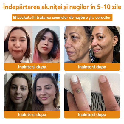 🧄𝐕𝐬𝐨𝐱𝐚™ 𝐕𝐞𝐧𝐢𝐧 𝐝𝐞 𝐚𝐥𝐛𝐢𝐧𝐞 𝐂𝐫𝐞𝐦ă 𝐩𝐞𝐧𝐭𝐫𝐮 î𝐧𝐝𝐞𝐩ä𝐫𝐭𝐚𝐫𝐞𝐚 𝐧𝐞𝐠𝐢𝐥𝐨𝐫 ş𝐢 𝐚𝐥𝐮𝐧𝐢𝐭𝐞𝐥𝐨𝐫🐝🐝(🔥𝙋𝙧𝙤𝙢𝙤ț𝙞𝙖 𝙙𝙚 𝙪𝙡𝙩𝙞𝙢𝙖 𝙯𝙞 𝟖𝟎% 𝙧𝙚𝙙𝙪𝙘𝙚𝙧𝙚)