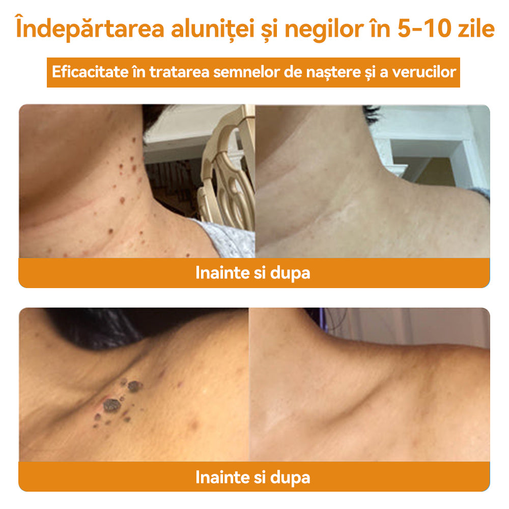 🧄𝐕𝐬𝐨𝐱𝐚™ 𝐕𝐞𝐧𝐢𝐧 𝐝𝐞 𝐚𝐥𝐛𝐢𝐧𝐞 𝐂𝐫𝐞𝐦ă 𝐩𝐞𝐧𝐭𝐫𝐮 î𝐧𝐝𝐞𝐩ä𝐫𝐭𝐚𝐫𝐞𝐚 𝐧𝐞𝐠𝐢𝐥𝐨𝐫 ş𝐢 𝐚𝐥𝐮𝐧𝐢𝐭𝐞𝐥𝐨𝐫🐝🐝(🔥𝙋𝙧𝙤𝙢𝙤ț𝙞𝙖 𝙙𝙚 𝙪𝙡𝙩𝙞𝙢𝙖 𝙯𝙞 𝟖𝟎% 𝙧𝙚𝙙𝙪𝙘𝙚𝙧𝙚)