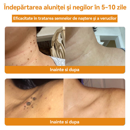 🧄𝐕𝐬𝐨𝐱𝐚™ 𝐕𝐞𝐧𝐢𝐧 𝐝𝐞 𝐚𝐥𝐛𝐢𝐧𝐞 𝐂𝐫𝐞𝐦ă 𝐩𝐞𝐧𝐭𝐫𝐮 î𝐧𝐝𝐞𝐩ä𝐫𝐭𝐚𝐫𝐞𝐚 𝐧𝐞𝐠𝐢𝐥𝐨𝐫 ş𝐢 𝐚𝐥𝐮𝐧𝐢𝐭𝐞𝐥𝐨𝐫🐝🐝(🔥𝙋𝙧𝙤𝙢𝙤ț𝙞𝙖 𝙙𝙚 𝙪𝙡𝙩𝙞𝙢𝙖 𝙯𝙞 𝟖𝟎% 𝙧𝙚𝙙𝙪𝙘𝙚𝙧𝙚)