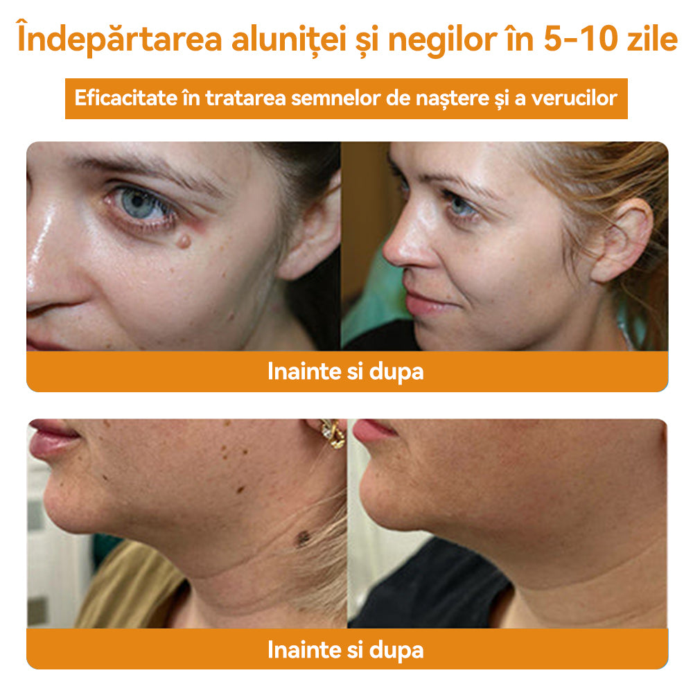 🧄𝐕𝐬𝐨𝐱𝐚™ 𝐕𝐞𝐧𝐢𝐧 𝐝𝐞 𝐚𝐥𝐛𝐢𝐧𝐞 𝐂𝐫𝐞𝐦ă 𝐩𝐞𝐧𝐭𝐫𝐮 î𝐧𝐝𝐞𝐩ä𝐫𝐭𝐚𝐫𝐞𝐚 𝐧𝐞𝐠𝐢𝐥𝐨𝐫 ş𝐢 𝐚𝐥𝐮𝐧𝐢𝐭𝐞𝐥𝐨𝐫🐝🐝(🔥𝙋𝙧𝙤𝙢𝙤ț𝙞𝙖 𝙙𝙚 𝙪𝙡𝙩𝙞𝙢𝙖 𝙯𝙞 𝟖𝟎% 𝙧𝙚𝙙𝙪𝙘𝙚𝙧𝙚)