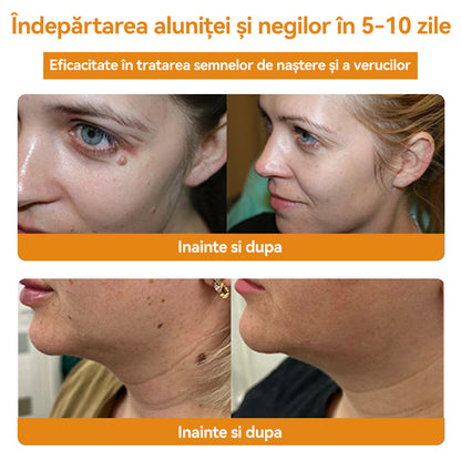 🧄𝐕𝐬𝐨𝐱𝐚™ 𝐕𝐞𝐧𝐢𝐧 𝐝𝐞 𝐚𝐥𝐛𝐢𝐧𝐞 𝐂𝐫𝐞𝐦ă 𝐩𝐞𝐧𝐭𝐫𝐮 î𝐧𝐝𝐞𝐩ä𝐫𝐭𝐚𝐫𝐞𝐚 𝐧𝐞𝐠𝐢𝐥𝐨𝐫 ş𝐢 𝐚𝐥𝐮𝐧𝐢𝐭𝐞𝐥𝐨𝐫🐝🐝(🔥𝙋𝙧𝙤𝙢𝙤ț𝙞𝙖 𝙙𝙚 𝙪𝙡𝙩𝙞𝙢𝙖 𝙯𝙞 𝟖𝟎% 𝙧𝙚𝙙𝙪𝙘𝙚𝙧𝙚)