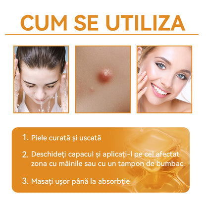 🧄𝐕𝐬𝐨𝐱𝐚™ 𝐕𝐞𝐧𝐢𝐧 𝐝𝐞 𝐚𝐥𝐛𝐢𝐧𝐞 𝐂𝐫𝐞𝐦ă 𝐩𝐞𝐧𝐭𝐫𝐮 î𝐧𝐝𝐞𝐩ä𝐫𝐭𝐚𝐫𝐞𝐚 𝐧𝐞𝐠𝐢𝐥𝐨𝐫 ş𝐢 𝐚𝐥𝐮𝐧𝐢𝐭𝐞𝐥𝐨𝐫🐝🐝(🔥𝙋𝙧𝙤𝙢𝙤ț𝙞𝙖 𝙙𝙚 𝙪𝙡𝙩𝙞𝙢𝙖 𝙯𝙞 𝟖𝟎% 𝙧𝙚𝙙𝙪𝙘𝙚𝙧𝙚)