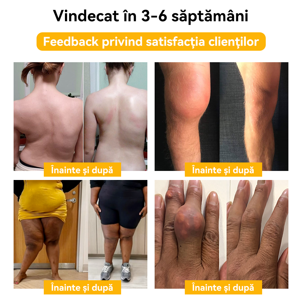 🐳𝐒𝐩𝐳𝐯™ 𝑽𝒆𝒏𝒊𝒏 𝒅𝒆 𝒂𝒍𝒃𝒊𝒏𝒆𝑪𝒓𝒆𝒎ă 𝒅𝒆 𝒕𝒓𝒂𝒕𝒂𝒎𝒆𝒏𝒕 𝒑𝒆𝒏𝒕𝒓𝒖 𝒂𝒓𝒕𝒊𝒄𝒖𝒍𝒂ț𝒊𝒊 ș𝒊 𝒐𝒂𝒔𝒆 🐝(𝑬𝒙𝒕𝒓𝒂𝒄𝒕 𝒅𝒆 𝒂𝒍𝒃𝒊𝒏𝒆 𝒅𝒊𝒏 𝑵𝒐𝒖𝒂 𝒁𝒆𝒆𝒍𝒂𝒏𝒅ă𝑺𝒑𝒆𝒄𝒊𝒂𝒍𝒊𝒛𝒂𝒕 î𝒏 𝒃𝒐𝒍𝒊 𝒐𝒓𝒕𝒐𝒑𝒆𝒅𝒊𝒄𝒆 ș𝒊 𝒅𝒖𝒓𝒆𝒓𝒊 𝒅𝒆 𝒂𝒓𝒕𝒓𝒊𝒕ă)