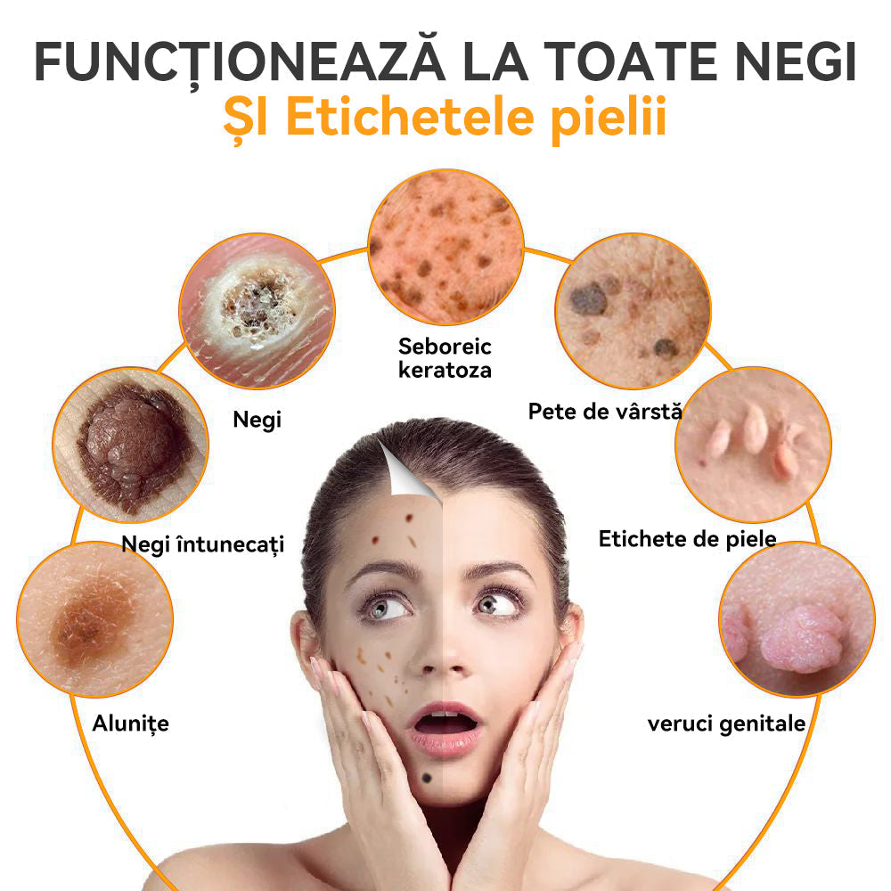 🥝𝑺𝒑𝒛𝒗™ 𝑽𝒆𝒏𝒊𝒏 𝒅𝒆 𝒂𝒍𝒃𝒊𝒏𝒆 𝑪𝒓𝒆𝒎ă 𝒅𝒆 𝒕𝒓𝒂𝒕𝒂𝒎𝒆𝒏𝒕 𝒑𝒆𝒏𝒕𝒓𝒖 𝒂𝒍𝒖𝒏𝒊ț𝒆 ș𝒊 𝒗𝒆𝒓𝒖𝒄𝒊 ⚡⚡(🧑‍⚕️𝑹𝒆𝒄𝒐𝒎𝒂𝒏𝒅𝒂𝒓𝒆𝒂 𝒅𝒆𝒓𝒎𝒂𝒕𝒐𝒍𝒐𝒈𝒖𝒍𝒖𝒊 𝒔𝒑𝒆𝒄𝒊𝒂𝒍𝒊𝒔𝒕🔥🔥𝑼𝒍𝒕𝒊𝒎𝒂 𝒛𝒊 𝒅𝒆 𝒑𝒓𝒐𝒎𝒐𝒗𝒂𝒓𝒆𝒍 80% 𝒐𝒇𝒇)