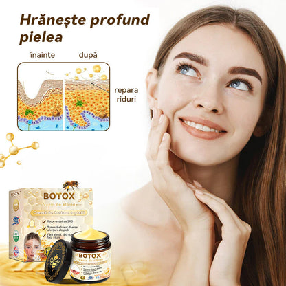 Oficial al Clinicii Mayo:🦙 𝐒𝐩𝐳𝐯™ 𝐁𝐎𝐓𝐎𝐗 𝐕𝐞𝐧𝐢𝐧 𝐝𝐞 𝐚𝐥𝐛𝐢𝐧𝐞 𝐂𝐫𝐞𝐦ă 𝐝𝐞 𝐭𝐫𝐚𝐭𝐚𝐫𝐞 𝐚 𝐩𝐢𝐞𝐥𝐢𝐢, Hidratare, repararea pielii, ton uniform, tratament pentru acnee și pete întunecate, îndepărtarea negilor și alunițelor, ameliorarea psoriazisului