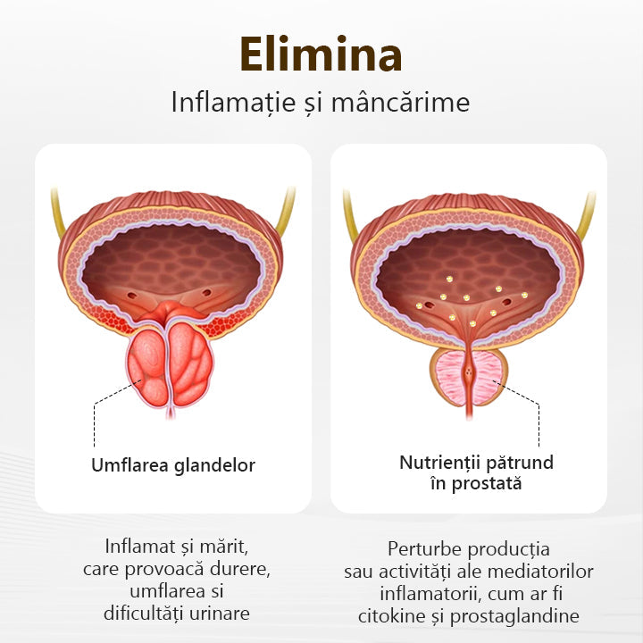 Spune-ți adio disconfortului de prostată🍀𝐋𝐄𝐅𝐔𝐍™ 𝐏𝐫𝐨𝐬𝐭𝐚𝐏𝐨𝐰𝐞𝐫 𝐁𝐞𝐞 𝐈𝐧𝐡𝐚𝐥𝐚𝐭𝐢𝐨𝐧 𝐒𝐭𝐢𝐜𝐤🍀(Acțiune rapidă și de lungă durată)