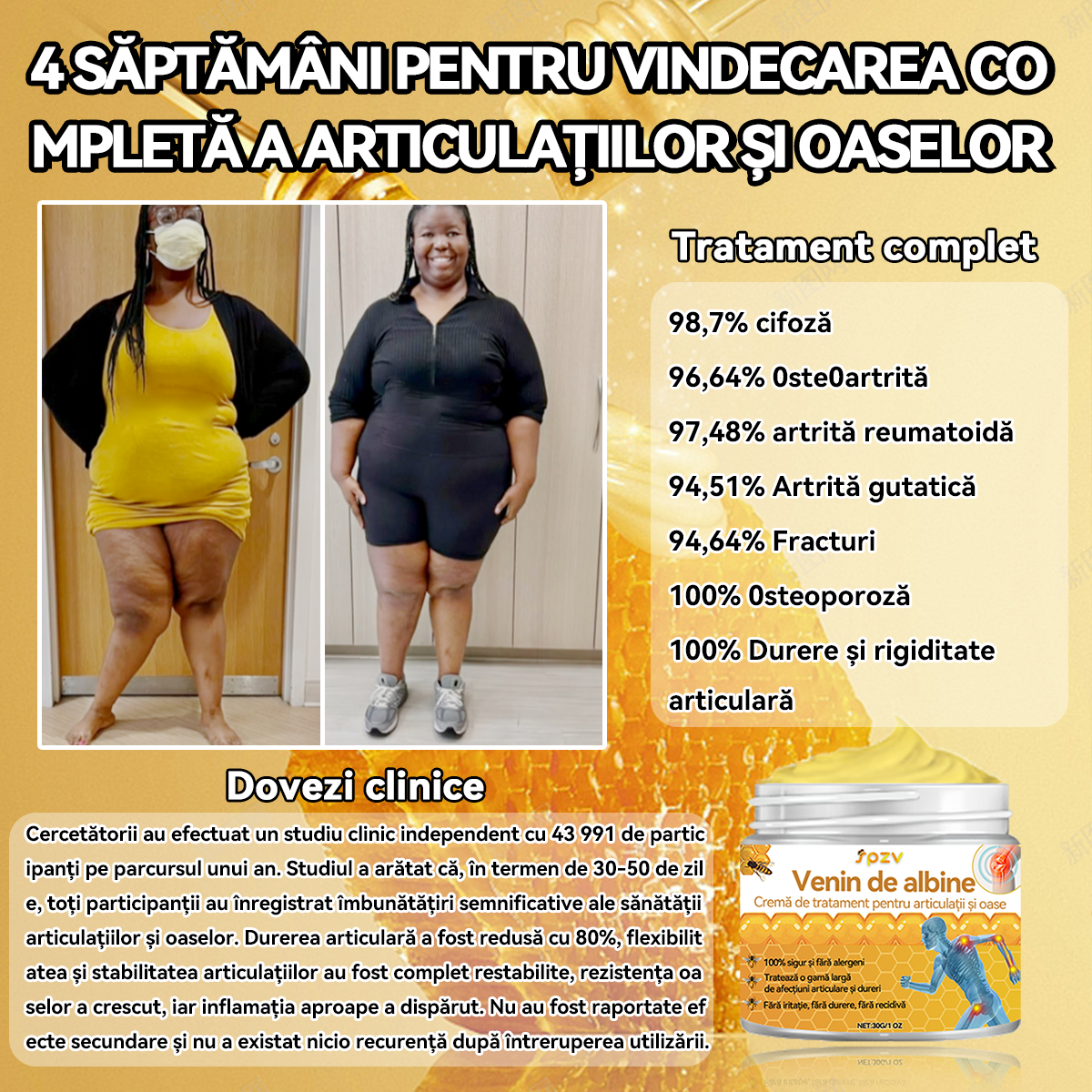 🐳𝐒𝐩𝐳𝐯™ 𝑽𝒆𝒏𝒊𝒏 𝒅𝒆 𝒂𝒍𝒃𝒊𝒏𝒆𝑪𝒓𝒆𝒎ă 𝒅𝒆 𝒕𝒓𝒂𝒕𝒂𝒎𝒆𝒏𝒕 𝒑𝒆𝒏𝒕𝒓𝒖 𝒂𝒓𝒕𝒊𝒄𝒖𝒍𝒂ț𝒊𝒊 ș𝒊 𝒐𝒂𝒔𝒆 🐝(𝑬𝒙𝒕𝒓𝒂𝒄𝒕 𝒅𝒆 𝒂𝒍𝒃𝒊𝒏𝒆 𝒅𝒊𝒏 𝑵𝒐𝒖𝒂 𝒁𝒆𝒆𝒍𝒂𝒏𝒅ă𝑺𝒑𝒆𝒄𝒊𝒂𝒍𝒊𝒛𝒂𝒕 î𝒏 𝒃𝒐𝒍𝒊 𝒐𝒓𝒕𝒐𝒑𝒆𝒅𝒊𝒄𝒆 ș𝒊 𝒅𝒖𝒓𝒆𝒓𝒊 𝒅𝒆 𝒂𝒓𝒕𝒓𝒊𝒕ă)
