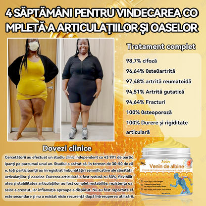🐳𝐒𝐩𝐳𝐯™ 𝑽𝒆𝒏𝒊𝒏 𝒅𝒆 𝒂𝒍𝒃𝒊𝒏𝒆𝑪𝒓𝒆𝒎ă 𝒅𝒆 𝒕𝒓𝒂𝒕𝒂𝒎𝒆𝒏𝒕 𝒑𝒆𝒏𝒕𝒓𝒖 𝒂𝒓𝒕𝒊𝒄𝒖𝒍𝒂ț𝒊𝒊 ș𝒊 𝒐𝒂𝒔𝒆 🐝(𝑬𝒙𝒕𝒓𝒂𝒄𝒕 𝒅𝒆 𝒂𝒍𝒃𝒊𝒏𝒆 𝒅𝒊𝒏 𝑵𝒐𝒖𝒂 𝒁𝒆𝒆𝒍𝒂𝒏𝒅ă𝑺𝒑𝒆𝒄𝒊𝒂𝒍𝒊𝒛𝒂𝒕 î𝒏 𝒃𝒐𝒍𝒊 𝒐𝒓𝒕𝒐𝒑𝒆𝒅𝒊𝒄𝒆 ș𝒊 𝒅𝒖𝒓𝒆𝒓𝒊 𝒅𝒆 𝒂𝒓𝒕𝒓𝒊𝒕ă)