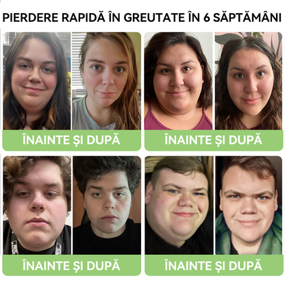 𝐃𝐨𝐫𝐦𝐨𝐫𝐧𝐚® GLP-1 Moringa Slăbire Sănătate Picături( 👨‍⚕️Arzător de grăsimi de calitate alimentară - Dezvoltat de Societatea Obezității)