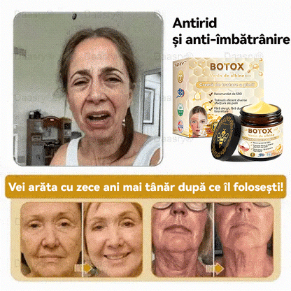 Oficial al Clinicii Mayo:🦙 𝐒𝐩𝐳𝐯™ 𝐁𝐎𝐓𝐎𝐗 𝐕𝐞𝐧𝐢𝐧 𝐝𝐞 𝐚𝐥𝐛𝐢𝐧𝐞 𝐂𝐫𝐞𝐦ă 𝐝𝐞 𝐭𝐫𝐚𝐭𝐚𝐫𝐞 𝐚 𝐩𝐢𝐞𝐥𝐢𝐢, Hidratare, repararea pielii, ton uniform, tratament pentru acnee și pete întunecate, îndepărtarea negilor și alunițelor, ameliorarea psoriazisului