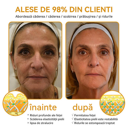 Oficial al Clinicii Mayo:🦙 𝐒𝐩𝐳𝐯™ 𝐁𝐎𝐓𝐎𝐗 𝐕𝐞𝐧𝐢𝐧 𝐝𝐞 𝐚𝐥𝐛𝐢𝐧𝐞 𝐂𝐫𝐞𝐦ă 𝐝𝐞 𝐭𝐫𝐚𝐭𝐚𝐫𝐞 𝐚 𝐩𝐢𝐞𝐥𝐢𝐢, Hidratare, repararea pielii, ton uniform, tratament pentru acnee și pete întunecate, îndepărtarea negilor și alunițelor, ameliorarea psoriazisului
